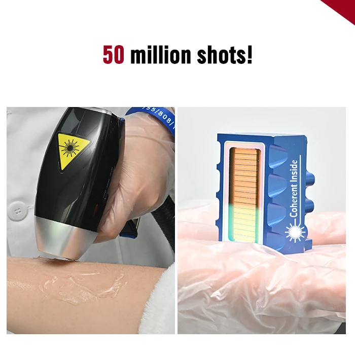 Portable Remote Control System Depilador Diode Laser 755 808 1064 Titanium Laser Hair Removal Machine