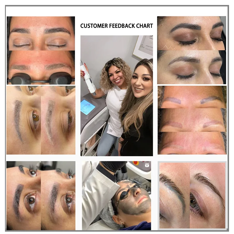 Whole Body Painless Hair Tattoo Removal Mini Portable Picolaser with Non-Bleeding No Bleach ND YAG Laser Type