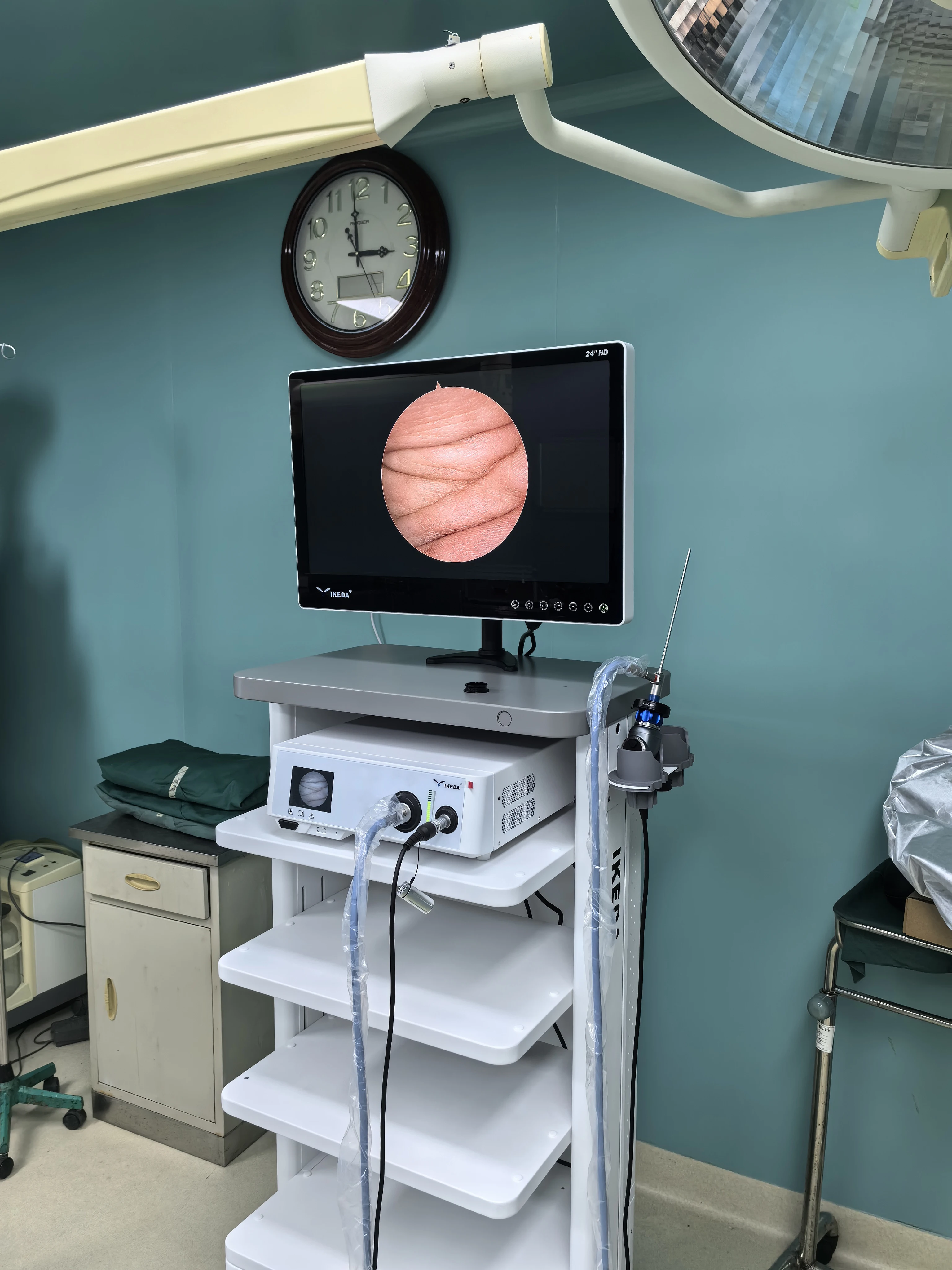 IKEDA Best Offer Surgical Laparoscopy Imaging Tower Medical ENT Endoscopic Camera Tower System