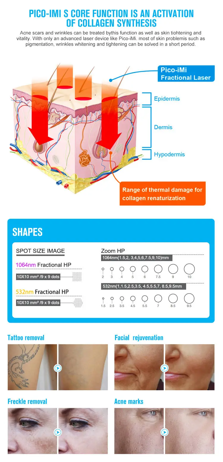 Best Brand Scar Mole Freckle Removal Q Switched Nd Yag Picolaser Tattoo Remove Laser Machine Picosecond