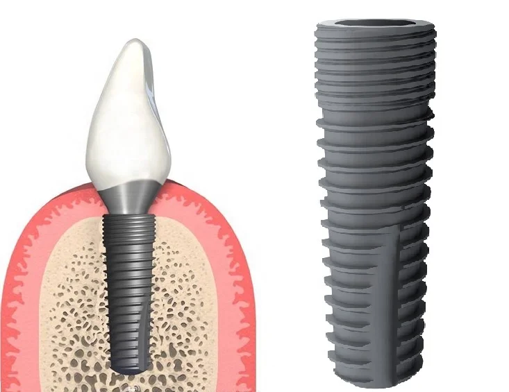 High Quality Self-tapping Dental Implants surgical kit  tooth implant  dental implant handpiece