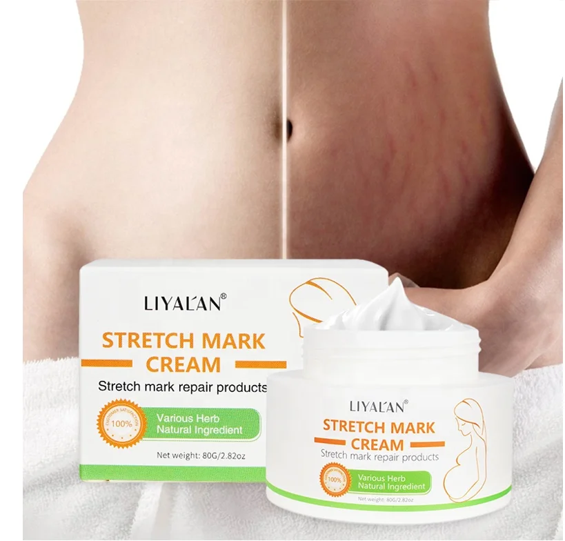 
 Private Label Stretchmark Remover Cream Natural Organic Body Scar Repair Slack Line Pregnancy Abdomen Anti Stretch Mark Cream  