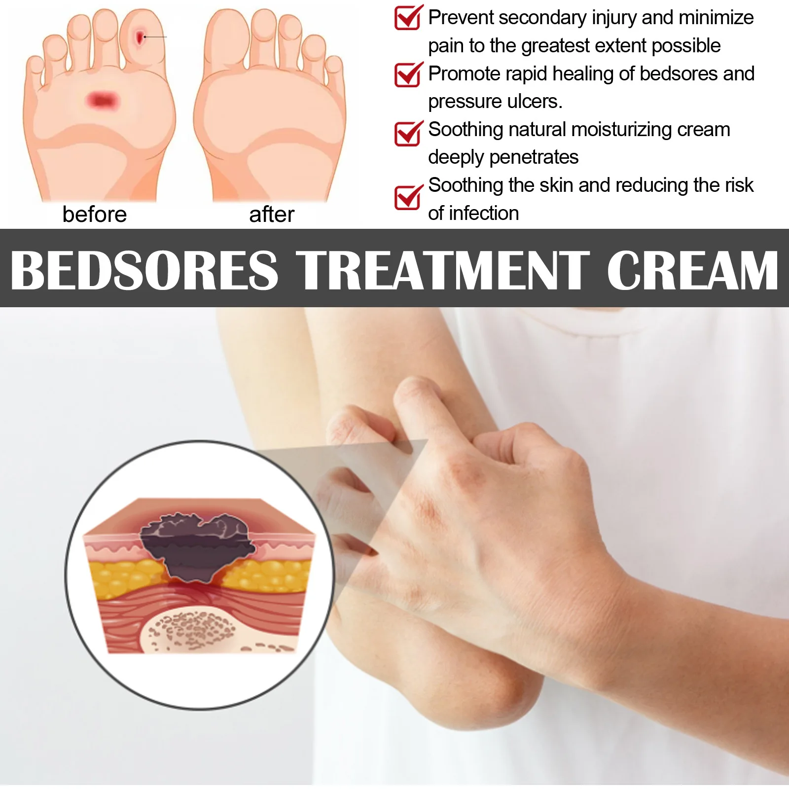 Private Label Fast Healing Bedsores Treatment Ointment Wound care Ointment Bedsores Cream Body Care Cream 20g
