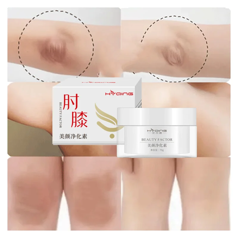 Hot sales Private label OEM skin moisturising lightening body bleaching  dark spot removing skin whitening cream