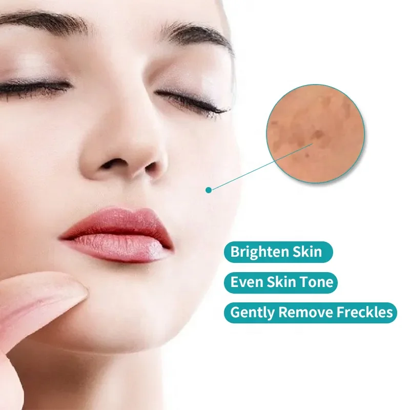 Face Whitening Freckle Remove Remover Lactic Acid Brightening Dark Spot Corrector Cream For Men Women