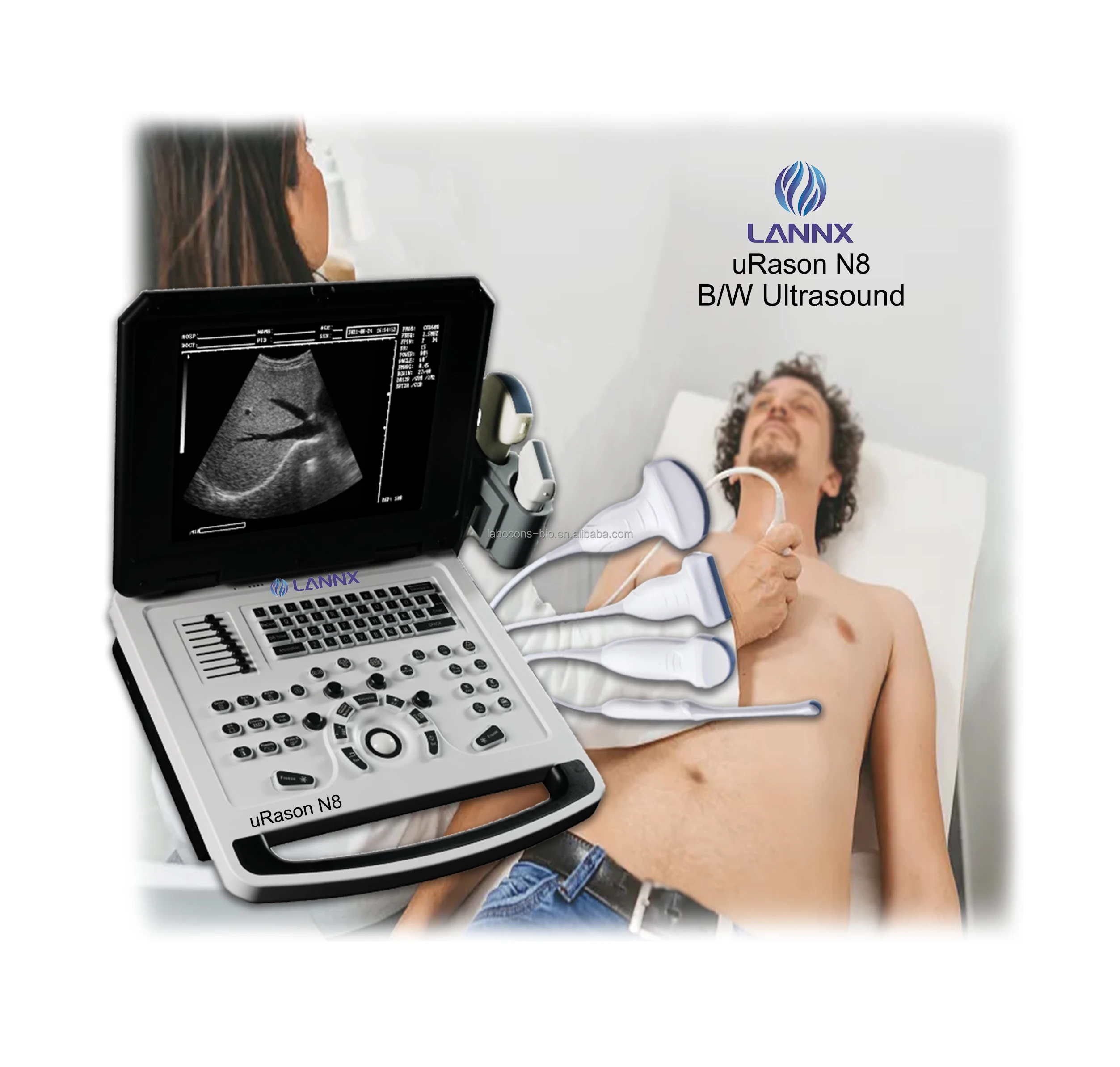 LANNX uRason N8 Priced to sell Digital Portable B/W Ultrasound Scanner for Human OB GYN Echocardiography Portable Usg Machine