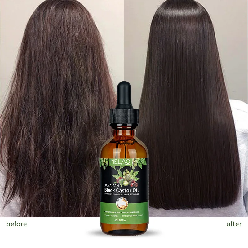 MELAO Pure Natural Jamaican Black Castor Hair Oil Hair Growth Soothe The Scalp Moisturize Body care Treatment Black Castor Oil