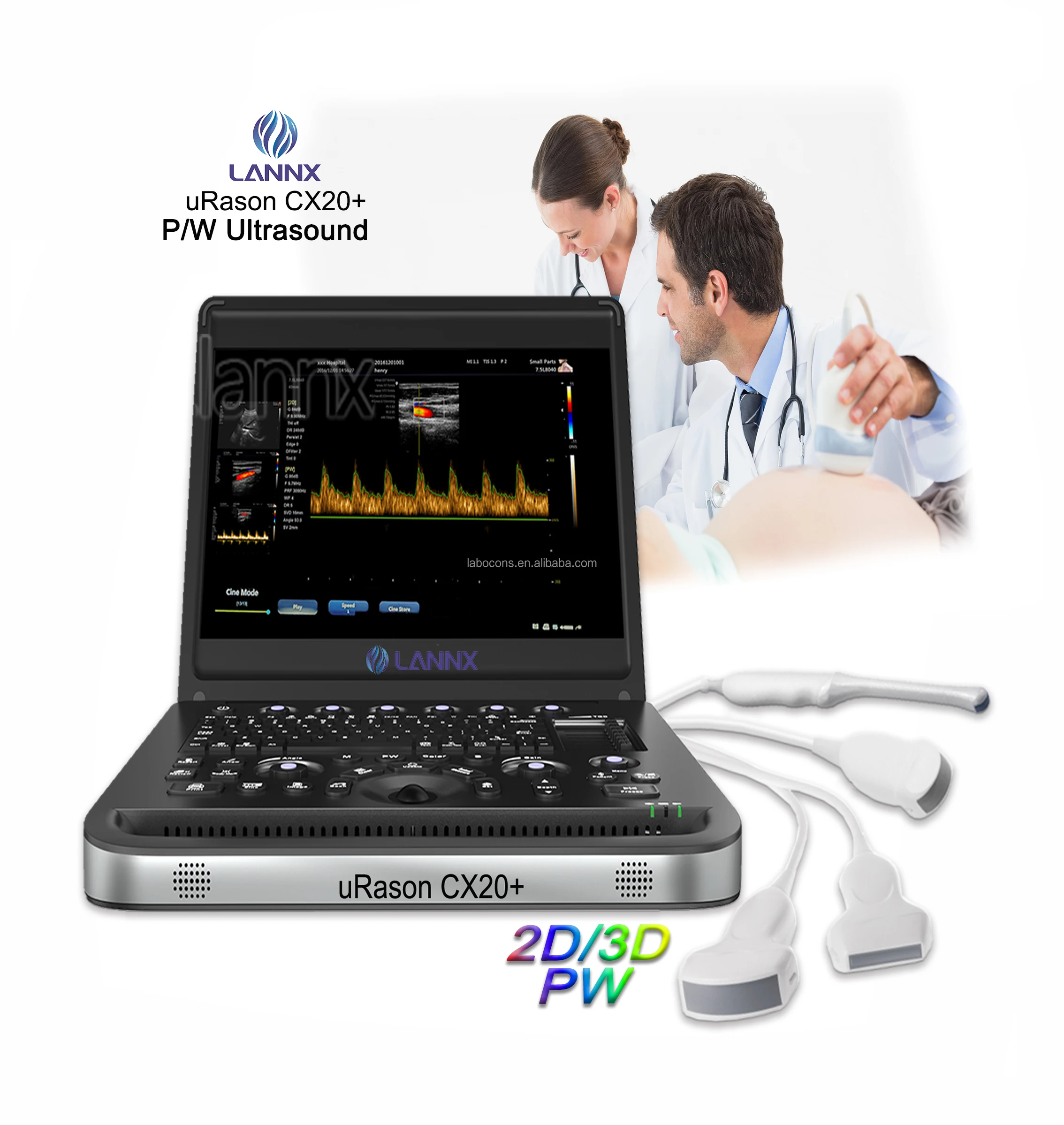 LANNX uRason CX20+ Cheap 15.6 inch 80 Elements Color Doppler Ultrasound Machine cardiac diagnostic echo ecografo portatil USG