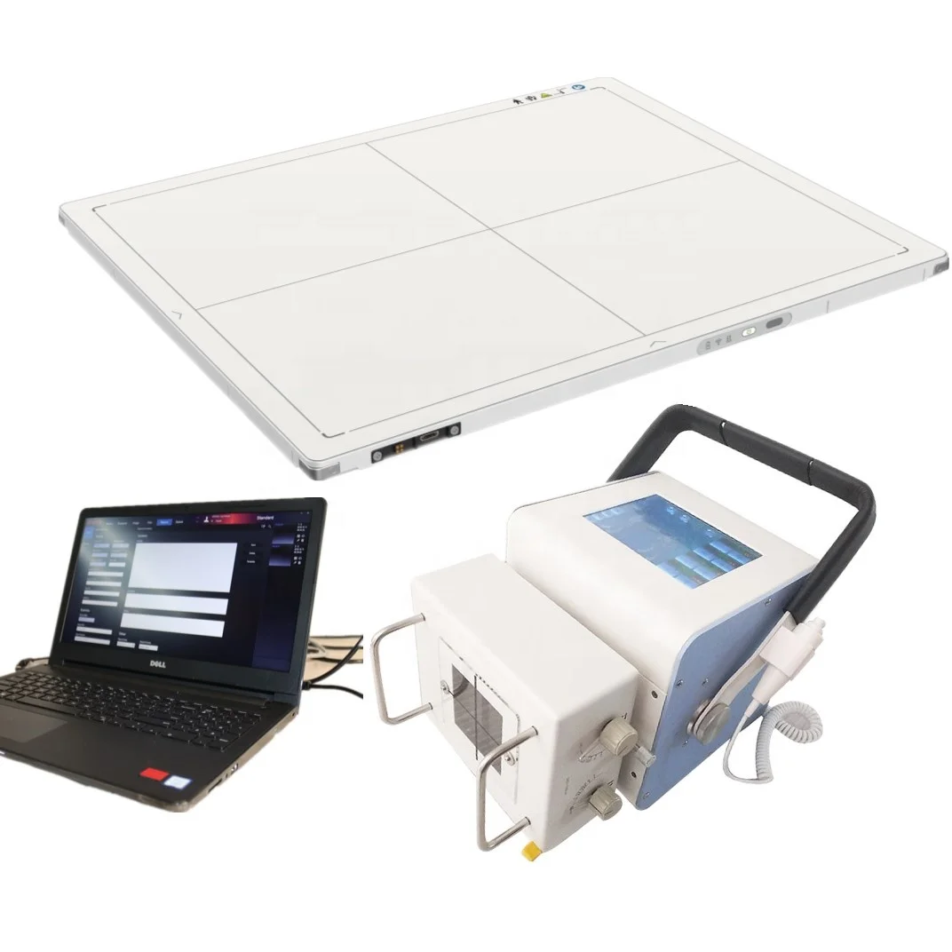 Iray Portable Digital X-Ray Flat Panel Detector for Digital Radiography Mars 1717V-VSI