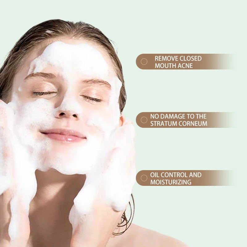 Acne Face Wash Cleanser Green Tea Natural Organic Smoothing Skin Salicylic Acid Deep Cleansing Foaming Facial Acne Cleanser