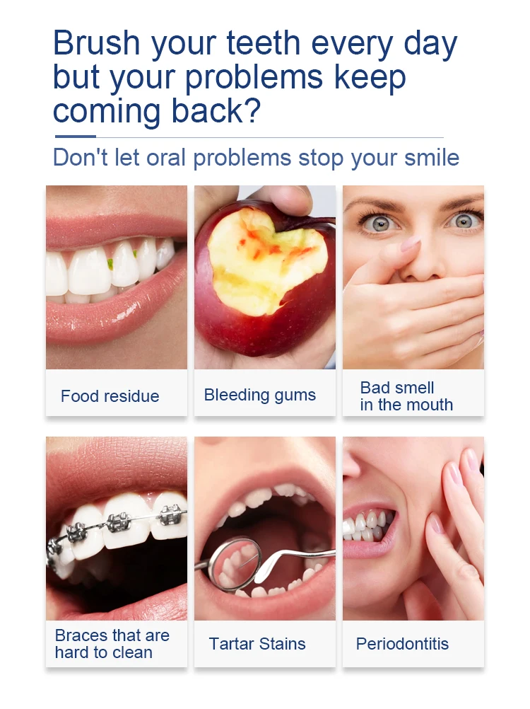 oral_irrigator (2)