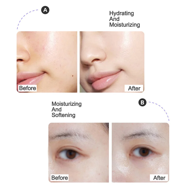 Beauty Skin Care Products Facial Serums VC Hyaluronic Acid Serum Private Label Niacinamide Zinc 1% Whitening Brighten Face Serum