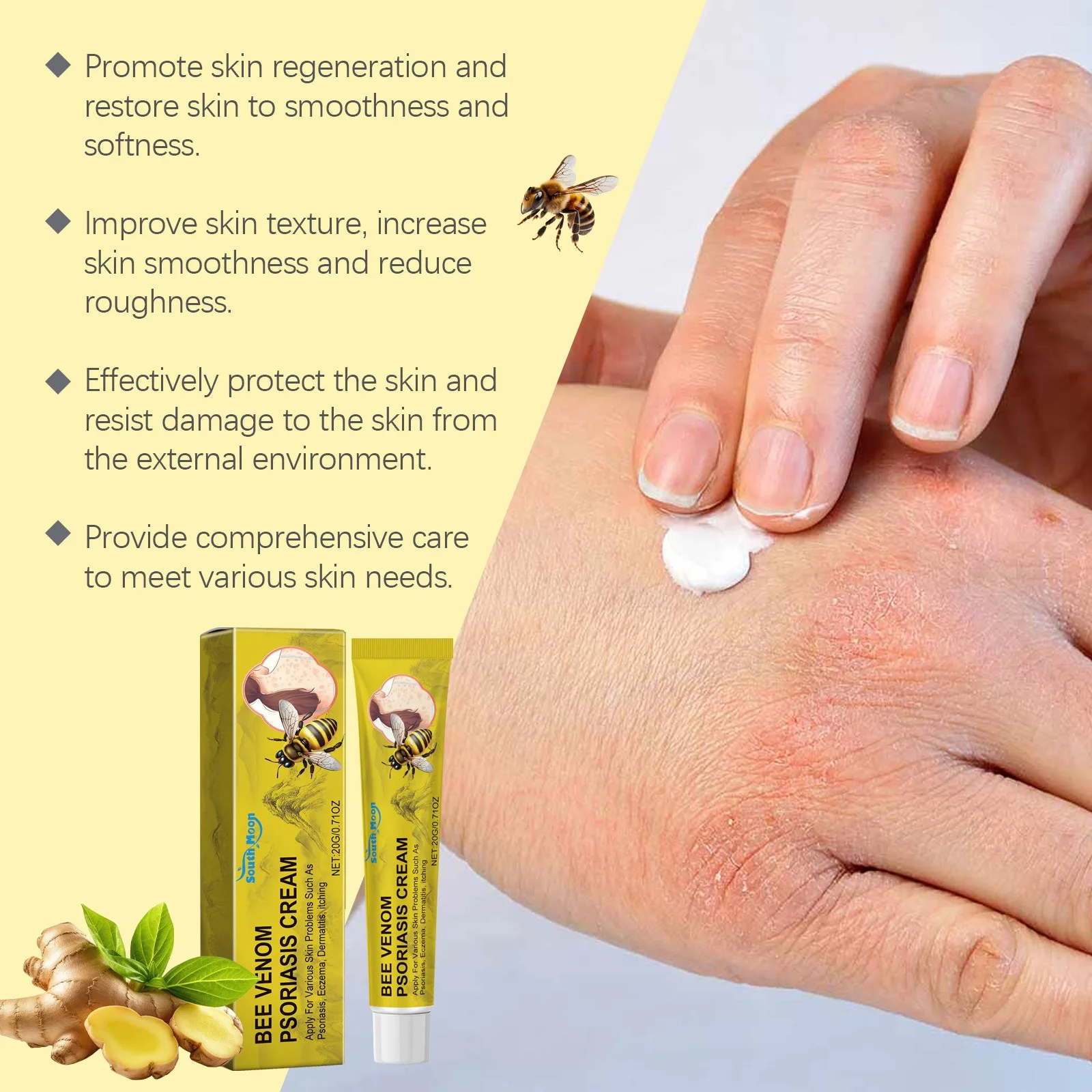 Bee Venom Fungal Skin Psoriasis Creams Dermatitis Eczema Ointment Treatment Psoriasis Cream