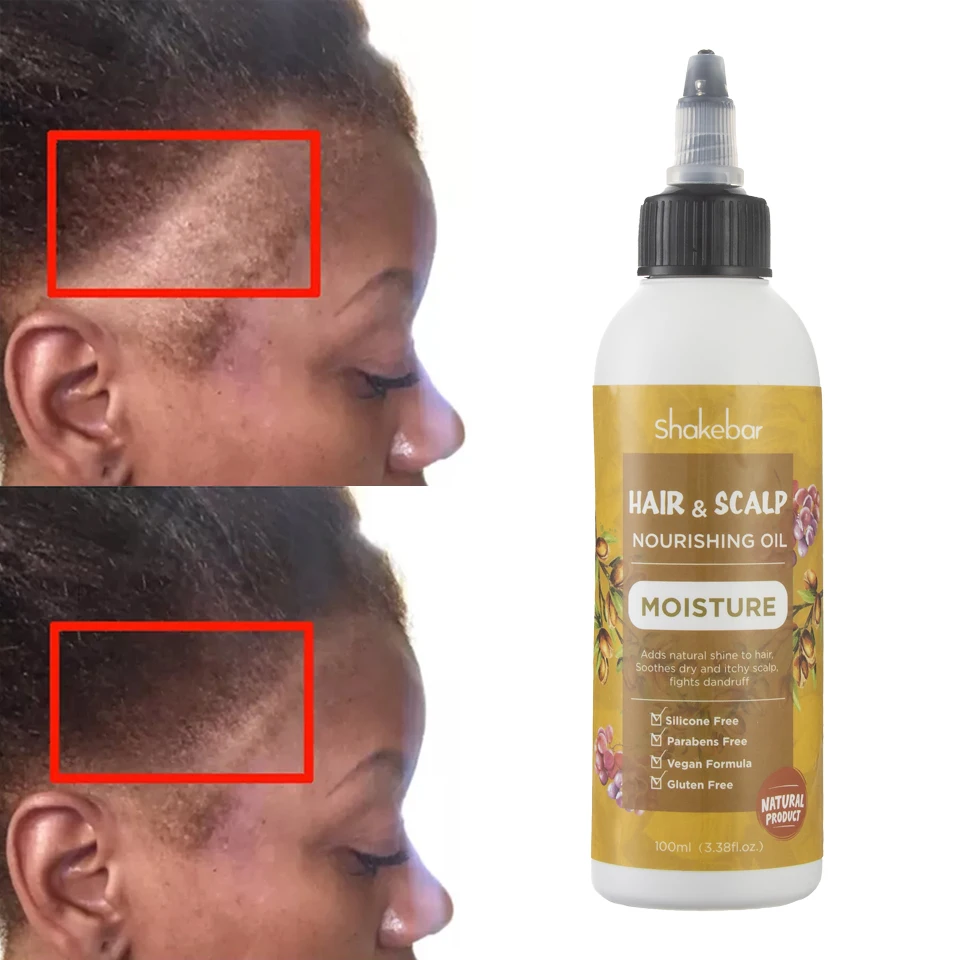 Shakebar Private Label Vitamin B5 Keratin Formula Wholesale Nourish Scalp Elixirs Hair Care Loss Treatment Hair Growth Oil Serum