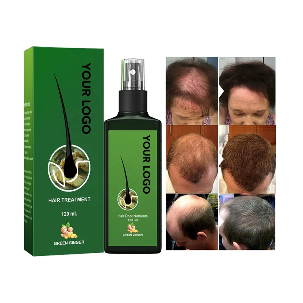 Hair Product Growth For Women Herbes Rapid Long Serum Hair Hair Growth Oil With No Label