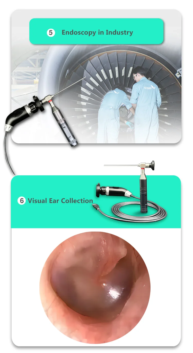 Medical endoscope HD USB Endoscopy Camera 1000 Lines CMOS 720P Medical Endoscope for Rigid Endocopic Ent