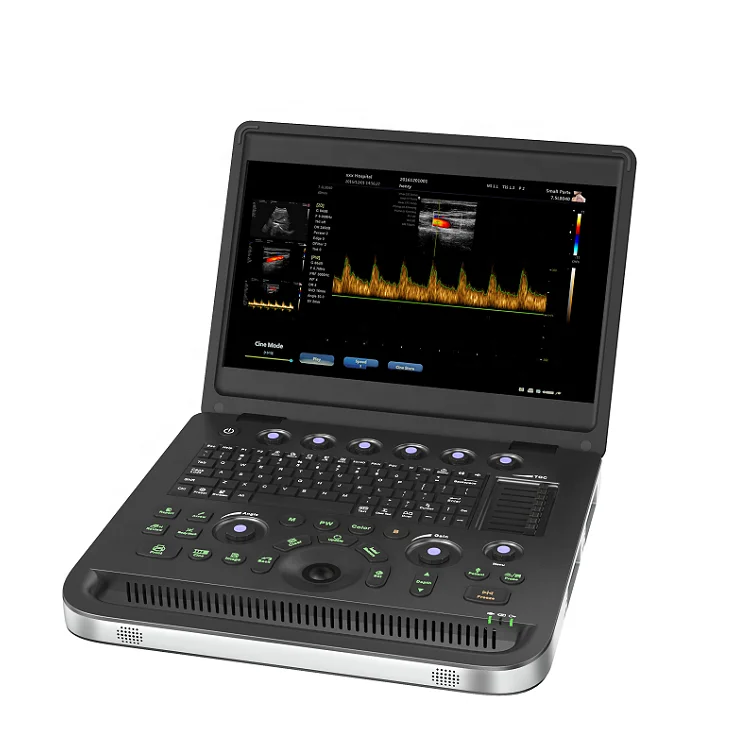 MN30 color doppler ultrasound machine price  portable color ultrasound scanner