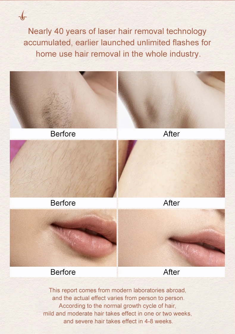 MISMON Painless Home IPL Machine Ice Cool Epilator for Permanent Hair Removal for Both Men and Women