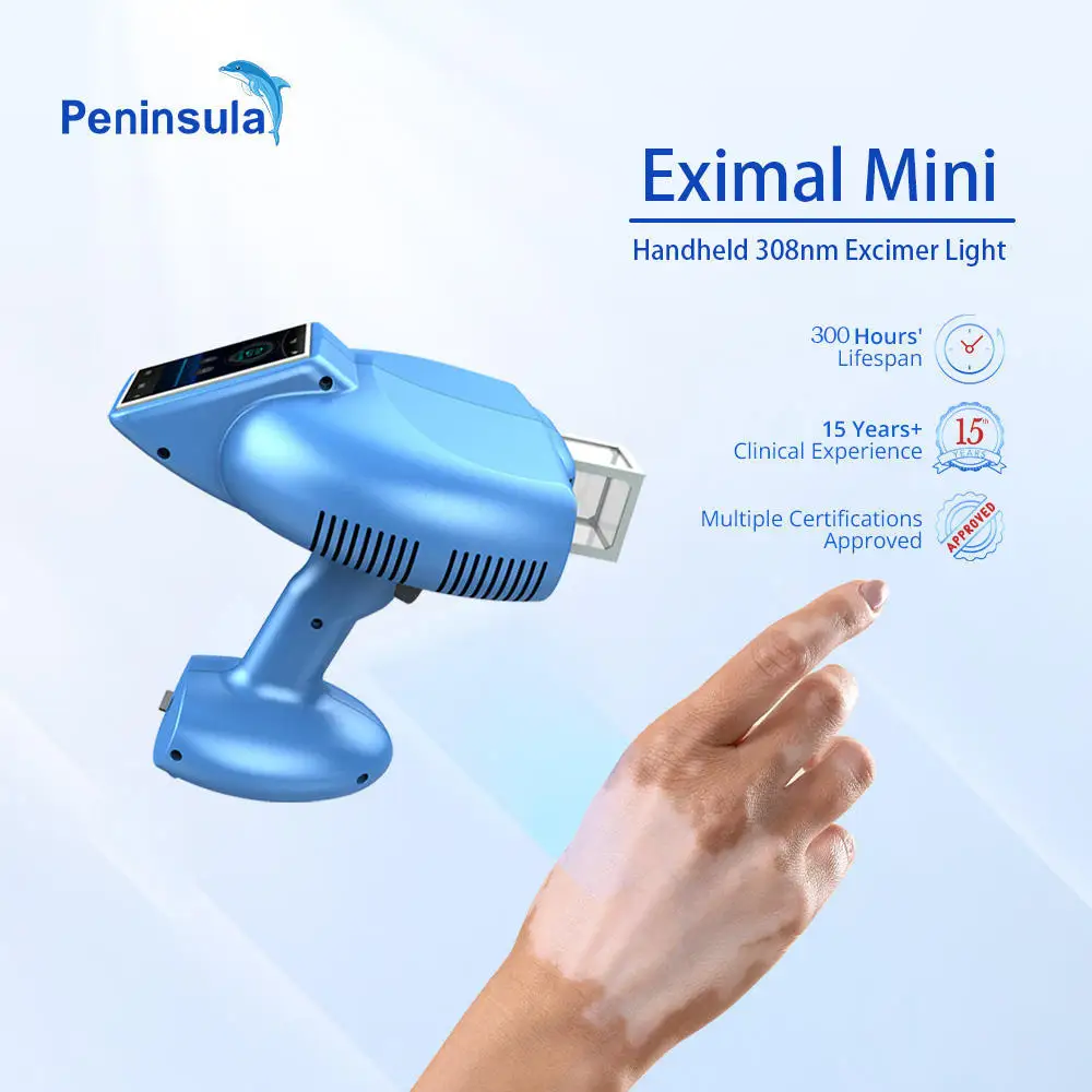 Peninsula Mini Excimer Laser 308nm Psoriasis Vitiligo Laser Machine Uvb Lamps For Psoriasis Treatment Nb uvb Lamp For Vitiligo