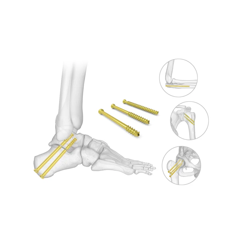 Orthopedic Medical Bone Cancellous Screw Countersunk Cannualated herbert screw