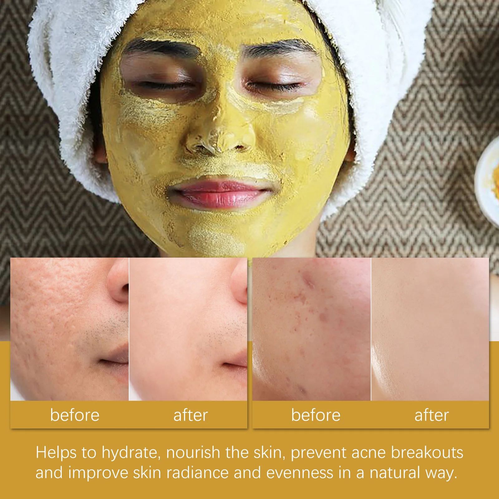 Private Label Face Skin Brighten Blackhead Removal Anti Acne Organic Turmeric Clay Mask - Buy Bentonite Clay Mask Tumeric Clay M