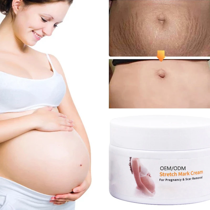 free shipping  stretch marks removal cream all skin stretch mark cream thailand quick and fastest cream for stretch marks
