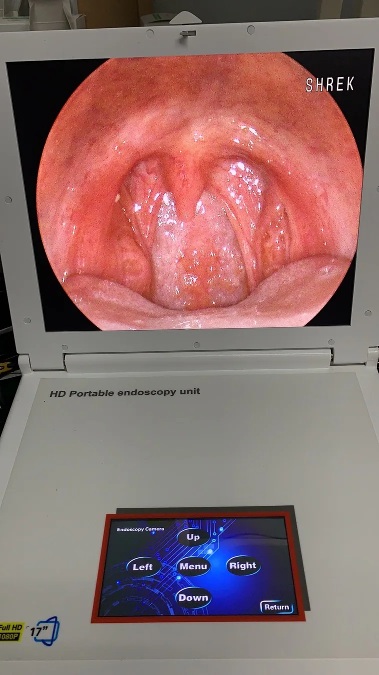 portable medical device 1080p full hd portable all-in-one endoscope camera