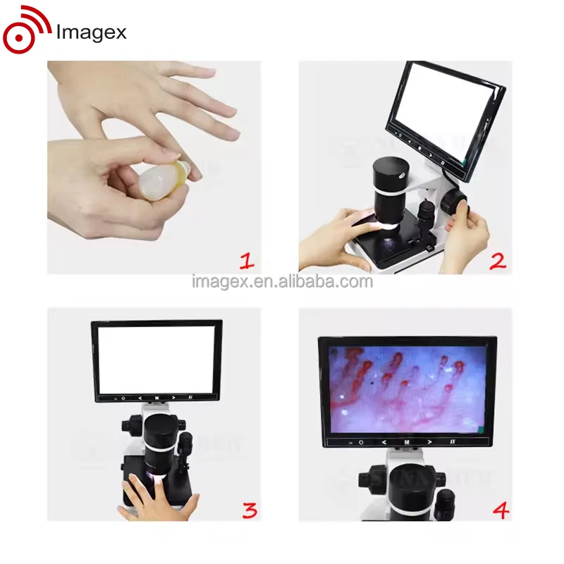 Дерматоскоп капилляроскопа для неинвазивных капиллярных и кожных наблюдений