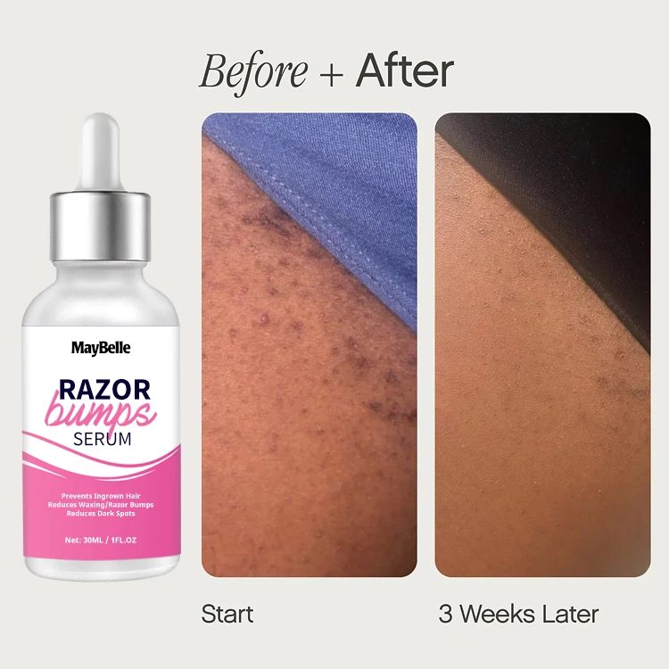 Private Label Razor Bump Serum Ingrown Hair Treatment Use After Shaving Hair Removal For Men and Women