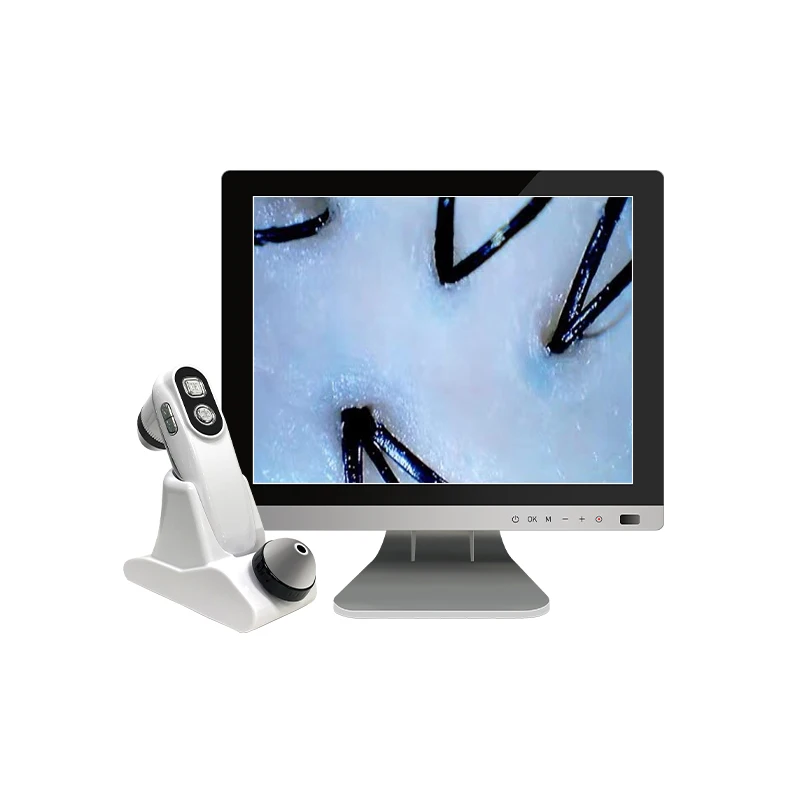 Meiboyi Portable 15.5 inch HD Hair follicle withered Skin Analysis Machine Scalp Camera Detector Beauty Equipment
