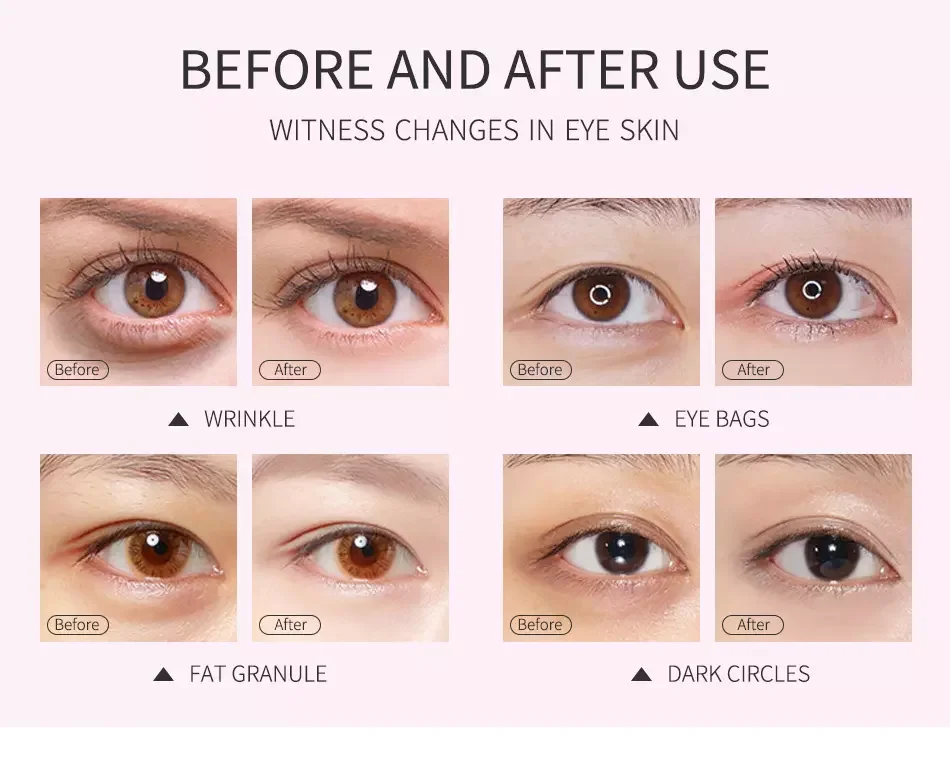 Top Selling Black Pearl Dark Circle Good Quality Eye Patch Under Eye Patches 24K Gold