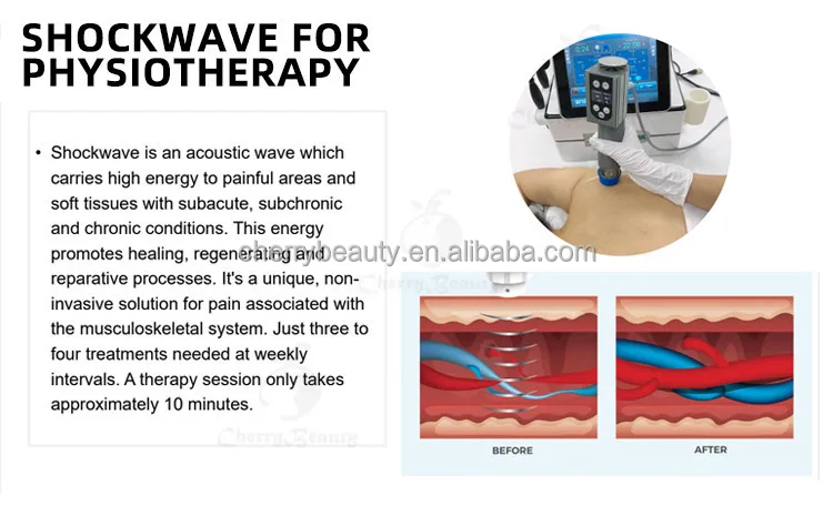 Tecar Ems Physical Pain Relief Indiba Physio Tecar Radiofrecuencia Diathermy 448khz cet ret tecar physical therapy physiotherapy