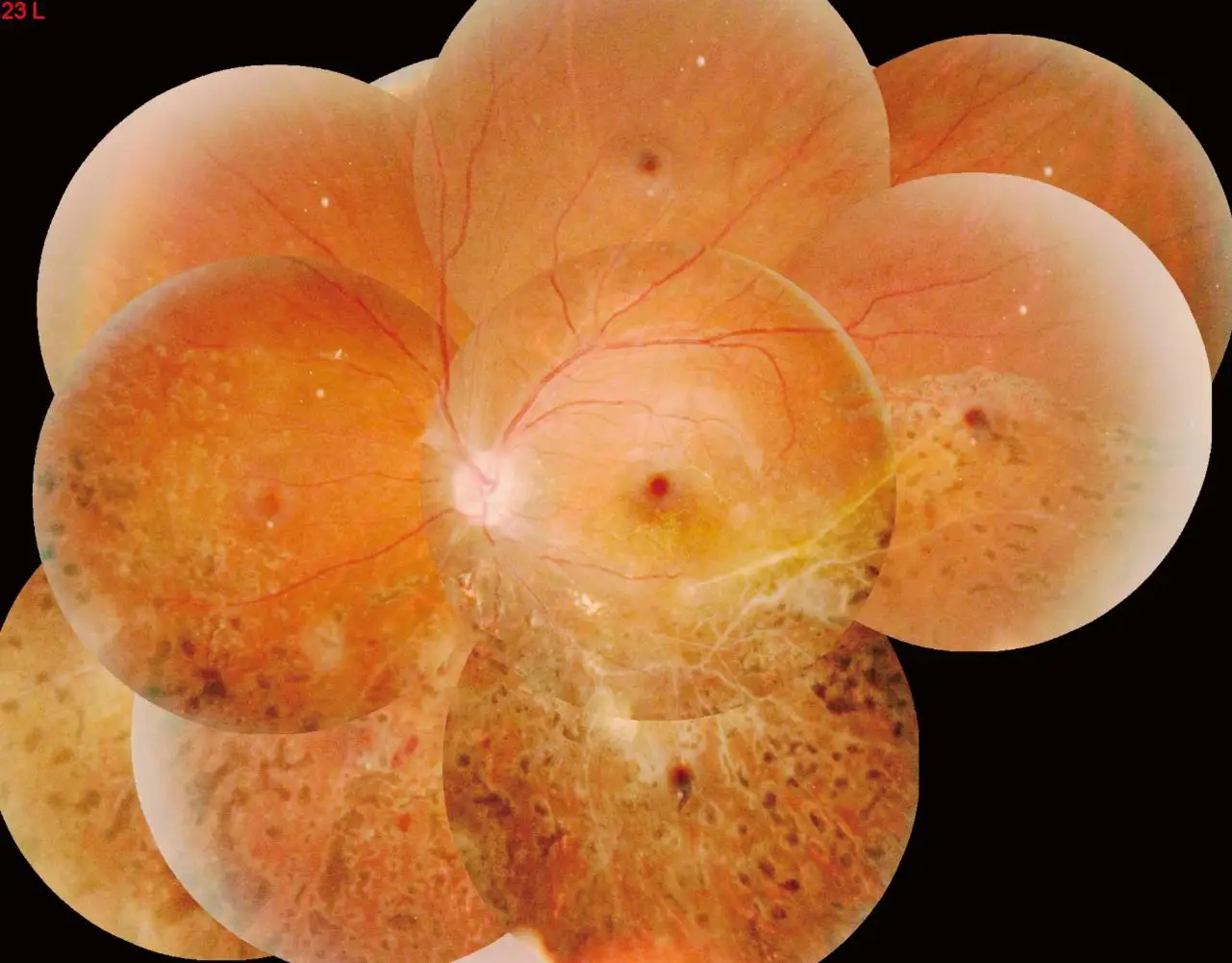 Высококачественная офтальмологическая камера Aps Non Mydriatic Eye Fundus