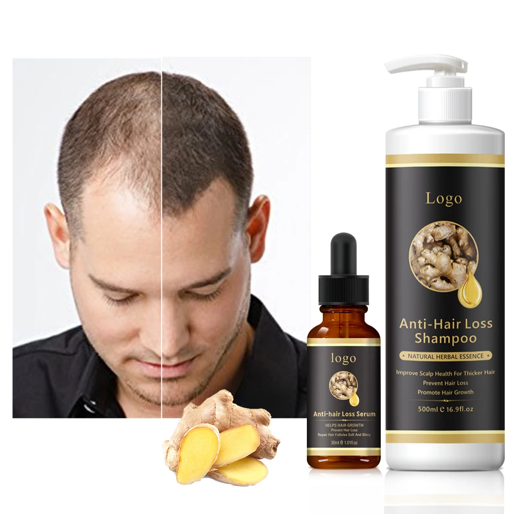 Private Label Natural Scalp Care Organic Ginger Anti loss Hair Wash Vegan Hair Growth Biotin Shampoo And Conditioner Kit