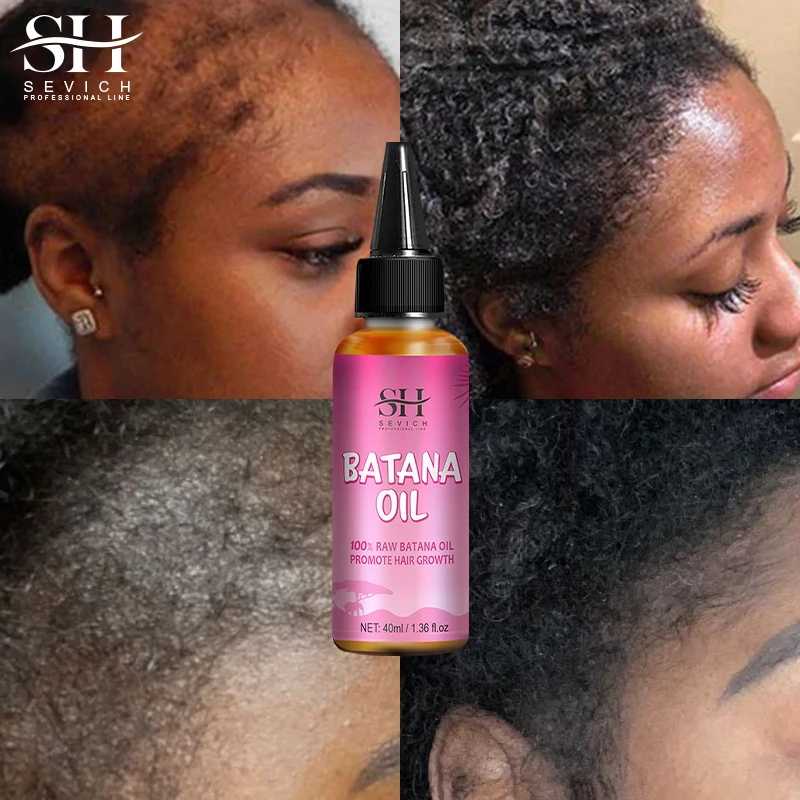 Cosmoprof Wholesale Healthy Repair Regrowth Honduras Hair Batana Growth Oil For Men Women Baldness