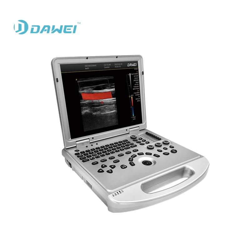 DW-L3 OEM portable notebook color Doppler vascular ultrasound