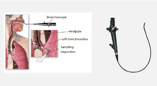 
Portable Flexible Endoscope With TF Record Card And 3.5 Inch Screen For ENT And Bronchoscopy 