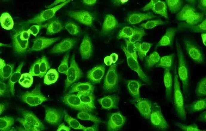 
Entry-level upright fluorescence microscope MF31 