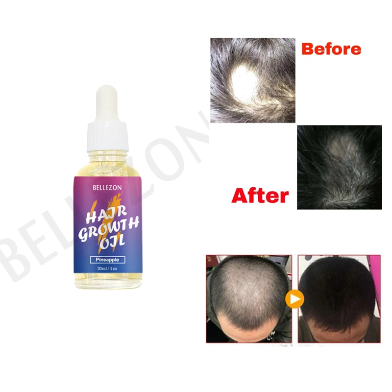 
Wholesale Private Label Natural Anti Hair Loss Hair Growth Oil Serum 