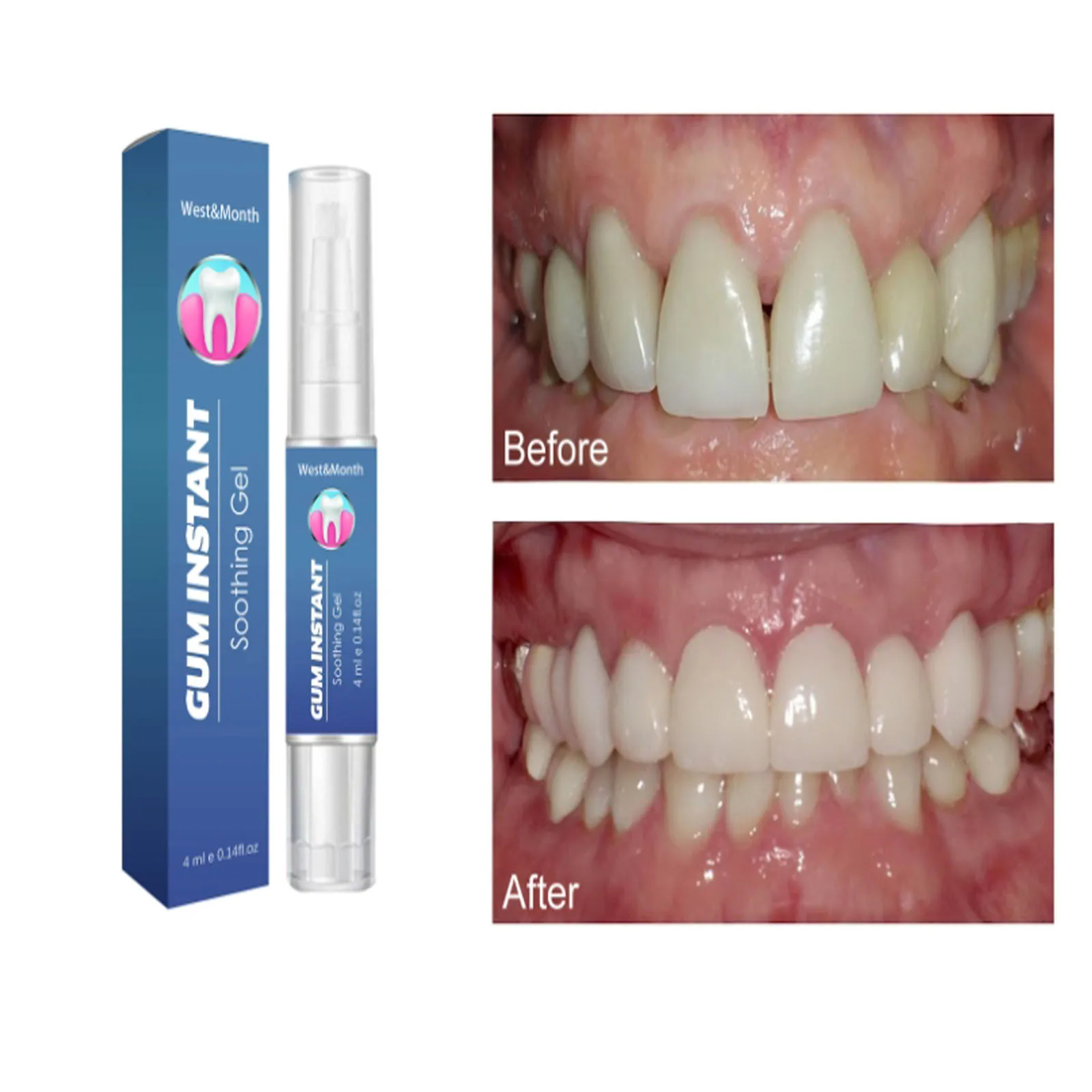 Gingival care gel relieves swelling pain of gingival receding clean stains whitening teeth Genuine wholesale price