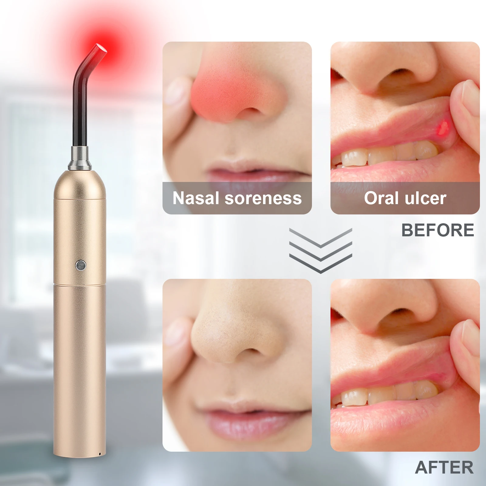 Photon Phototherapy Physiotherapy Infrared Portable 670nm Led Infra Deep Red Light Therapy Lamp Wand for Eyes-sight Improvement
