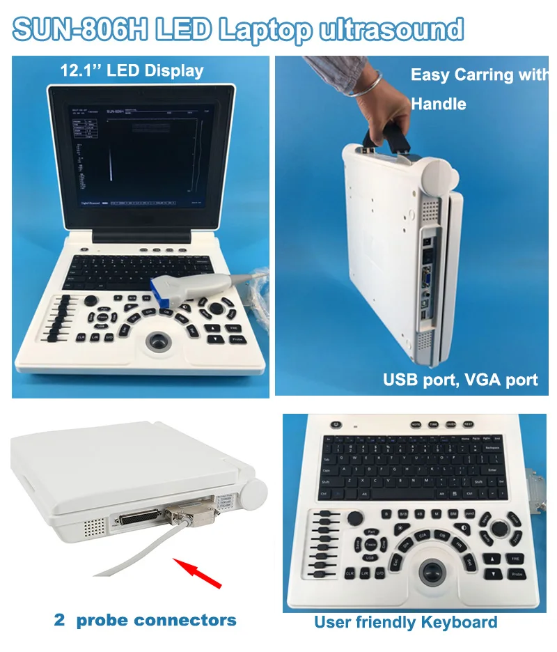 SUN-806H professional small 2D black and white ultrasound scanning blood vessel medical machine