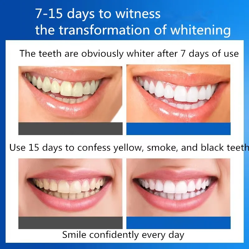 Factory Price Teeth Whitening Strips Advanced Tooth Bleaching Teeth Whitening Kit