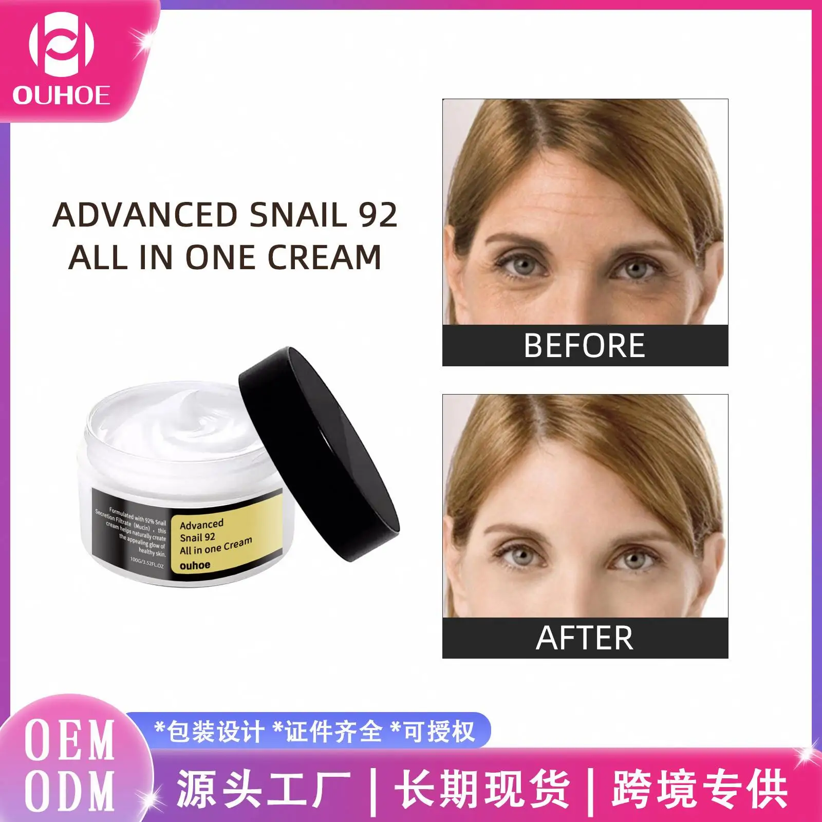 Best-selling  Facial Moisturizing Cream  Anti Acne Face Cream  Korean Face Cream  Factory Wholesale