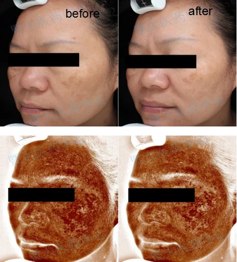 
Professional production active peptide recombinant human fgf1 powder 