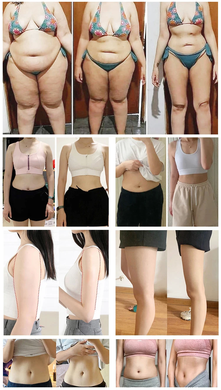 Ems Cryolipolysis 2 In 1 Body Reshape Slimming Machine Cryo Slim Cryolipolysis Ems Fat Freezing Weight Loss Cryotherapy Machine