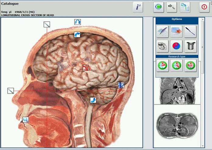 New arrival metapathia hospital 18d nls quantum analyzer metatron 4025 hunter with CE