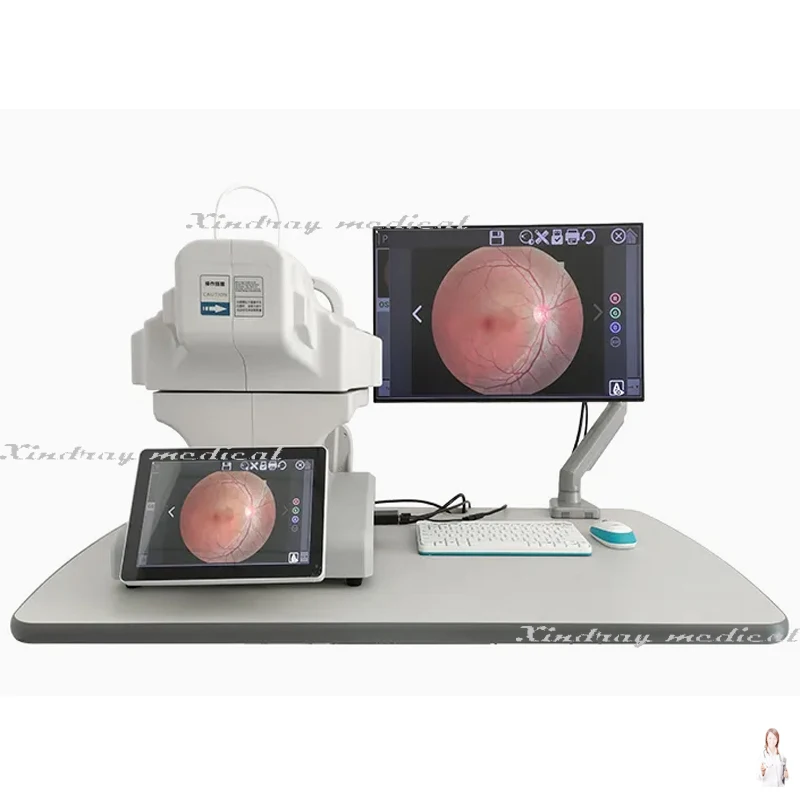 RC650b Ophthalmic Diagnosis Non Mydriatic Digital Retinal Fundus Camera with Ffa Function