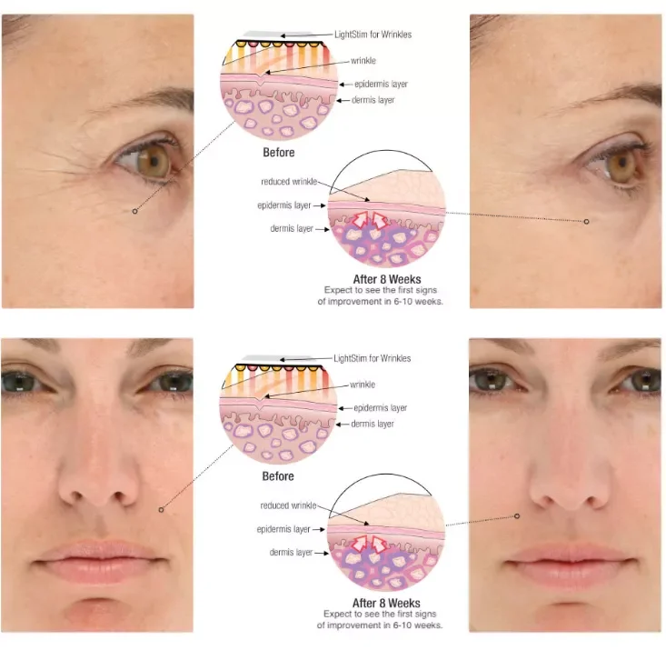 LED Light Therapy Device Photodynamic 7 Colors With High Power Piranha LEDS PDT Machine 5 Handles Light Therapy