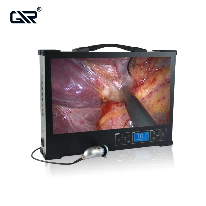 HD390 Integrated Medical 4K Portable Ureteroscopy ENT Endoscope Camera System